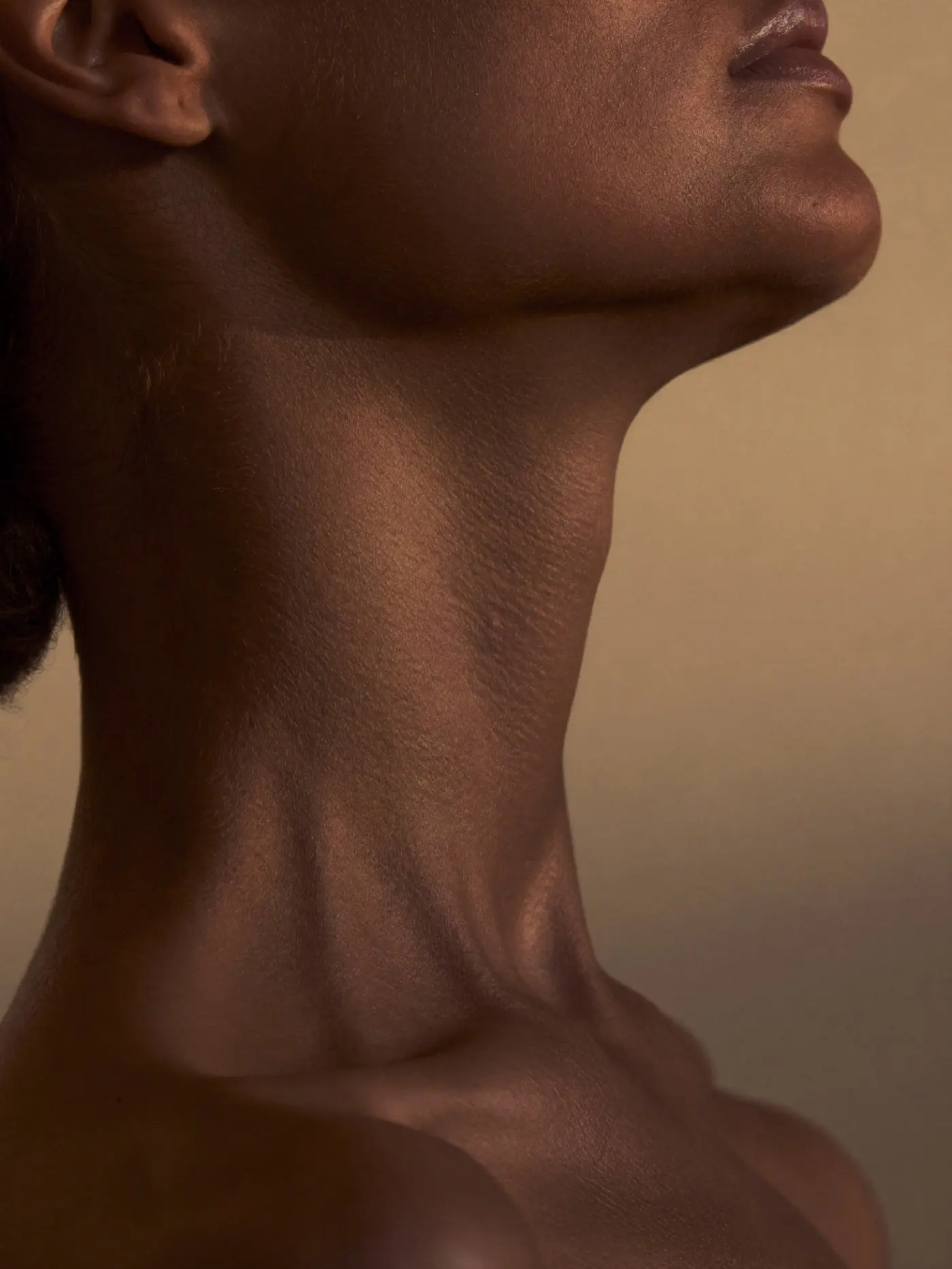 Perfilado Mandibular · Med Point Mexicali